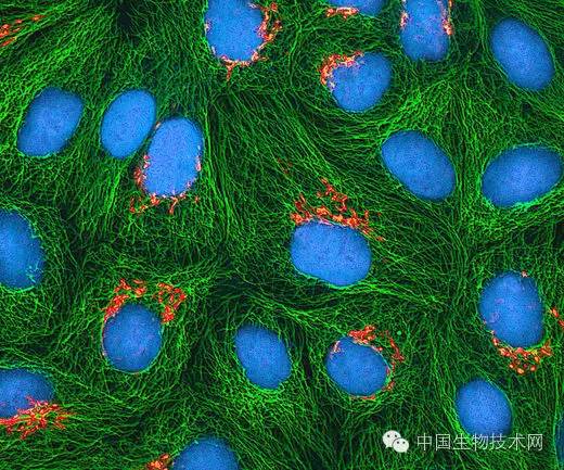 [microscope什么意思]microscope什么意思中文