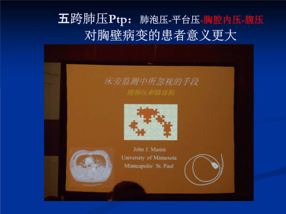 ptp立案成功追回平台的简单介绍